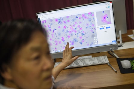 A laboratory technician conducts AI-based cervical cancer screening in Wuhan, China.