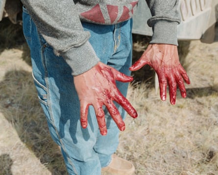 Two bloody hands