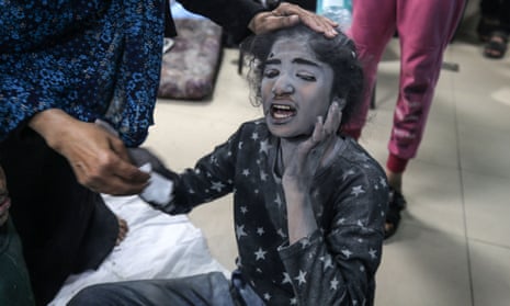 An injured Palestinian girl in Deir Al-Balah in the central Gaza Strip