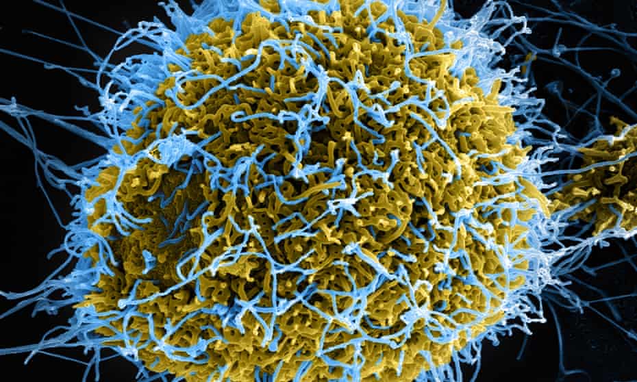 Colorized scanning electron micrograph of filamentous Ebola virus particles (blue) budding from chronically infected VERO E6 