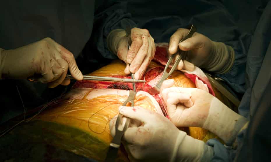 Doctors during a liver transplant