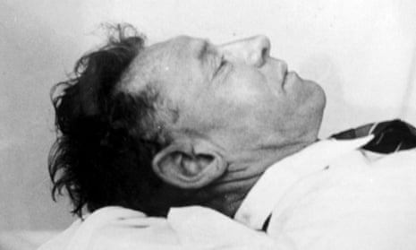 The Somerton Man shortly after autopsy