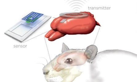 Artist’s rendition of the sensor and wireless transmitter monitoring a rat’s brain.