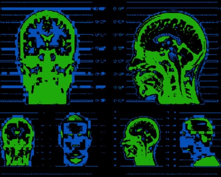 Brain scans from different angles.