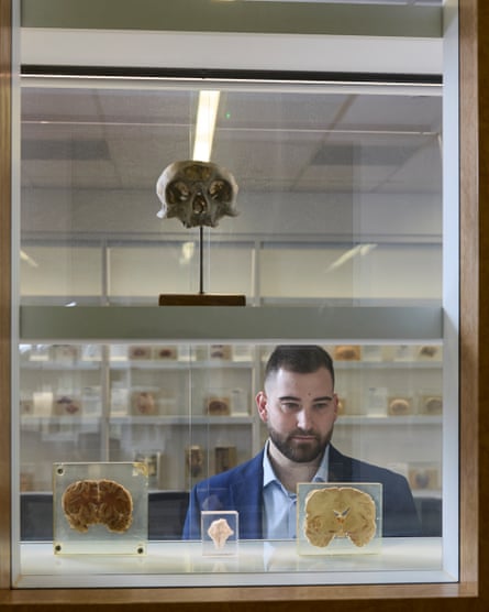 Ben Rein at the Brain Museum at the University of Buffalo, New York.