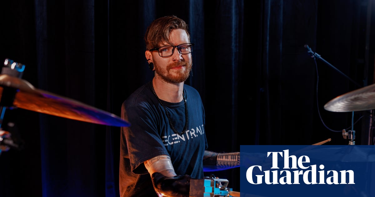 Experience: I lost my arm – now I’m one of the fastest drummers in the world