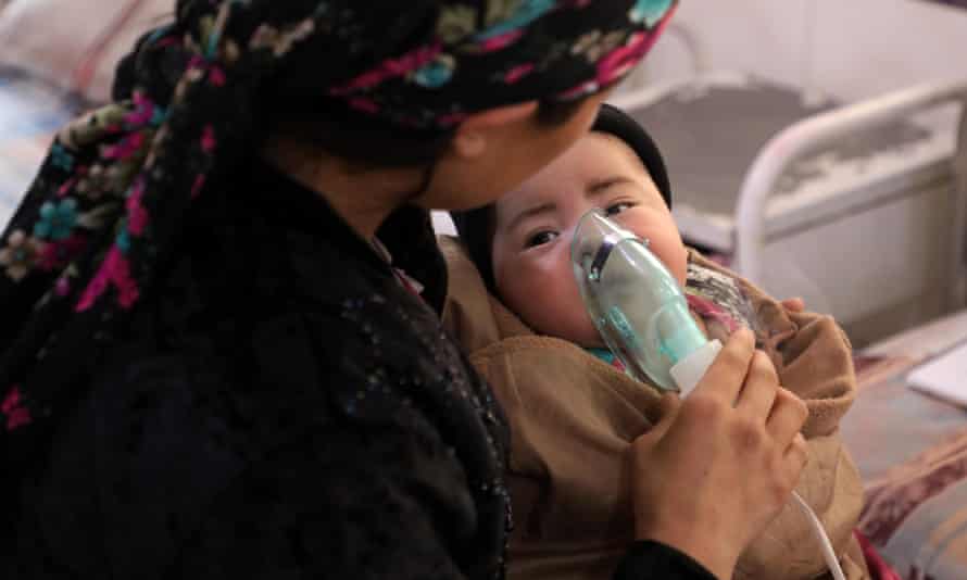A child with measles is treated in Kabul. 