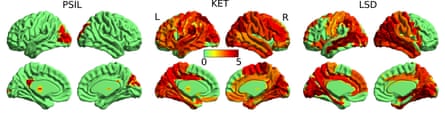 Brain activity with (left to right) psilocybin, ketamine and LSD