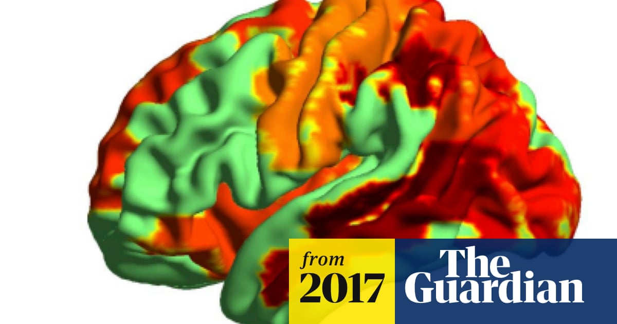 Psychedelic drugs induce 'heightened state of consciousness', brain scans show