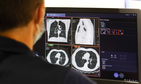 A health worker checks the result of a lung scan