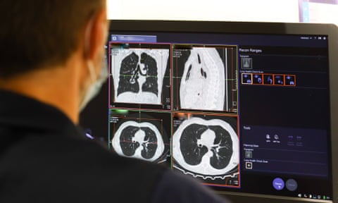 An NHS member looks at the results of a lung scan.