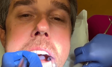 Beto O’Rourke offered Instagram users an intimate look at his oral hygiene.