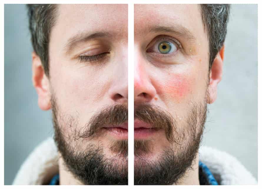 'In the meantime, friends and acquaintances monitor my face for evidence of improvements.'