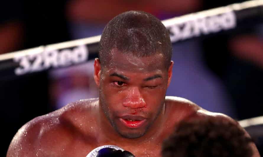 Brain Injury Charity Calls Criticism Of Daniel Dubois Irresponsible Boxing The Guardian Brain Injury Charity Calls Criticism Of Daniel Dubois Irresponsible Boxing The Guardian