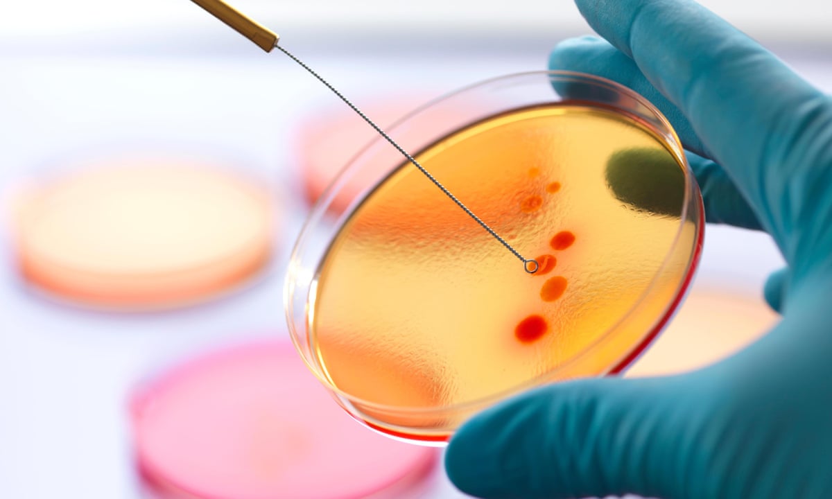 Antimicrobial resistance a ‘greater threat than cancer by 2050’ | Society | The Guardian