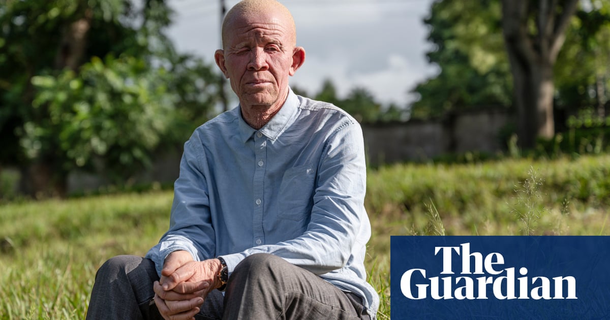 A friend killed, and inquiries shelved: life fighting the stigma of albinism in Malawi
