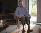 An Amputation Obsession: the Monster and the Surgeon review – an engrossing story, if you can stomach it