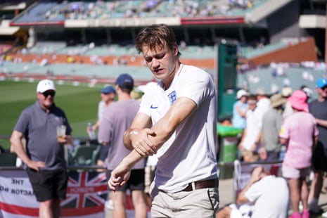 An England fan applies suncream