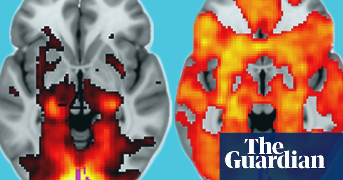 Tripping on LSD could unlock child-like creativity – video | Science