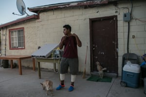 Jaziel Soto Torres outside of his home in the community of El Mayor, with bandages wrapped around his legs, to cover blisters that erupted after wading in the murky river Hardy.
