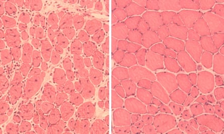 On the left is muscle tissue from an aged mouse. On the right is muscle tissue from an aged mouse that has been subjected to “reprogramming”.