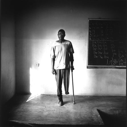 A former Angolan soldier who lost his leg to a mine, at a school to prepare soldiers for civilian life in Kuito, Angola.