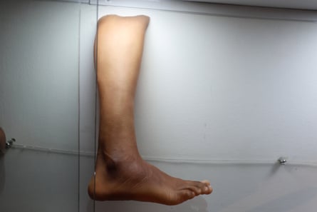 ‘Próteses não são feitas para pessoas como nós’: os irmãos criando próteses artificiais inovadoras...