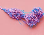 Life-prolonging drug for advanced ovarian cancer gets go-ahead in England