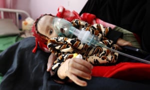 A malnourished Yemeni child receives treatment at a hospital in the capital Sanaa
