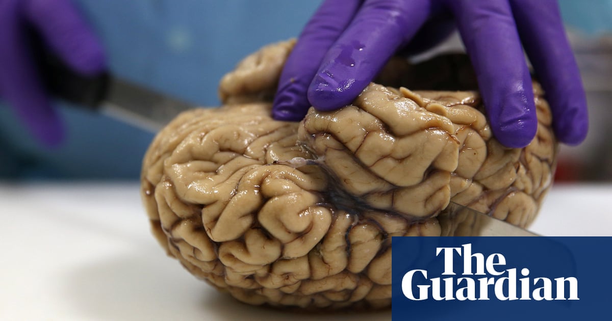 growing brains in labs why it s time for an ethical debate
