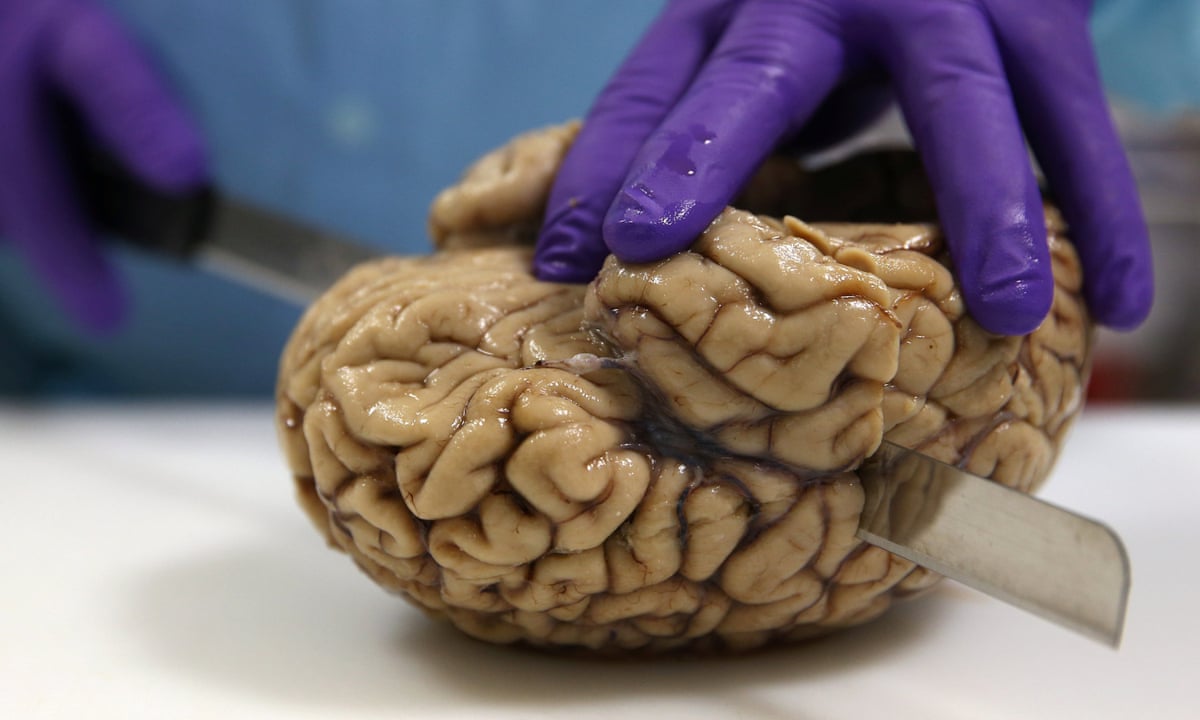 Growing brains in labs: why it's time for an ethical debate