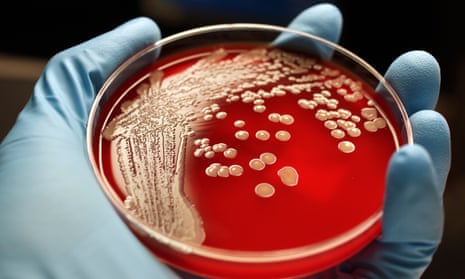 Hand holding blood agar plate containing MRSA colonies