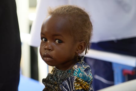 Crianças desnutridas e mães desesperadas: a unidade de saúde na linha de frente...