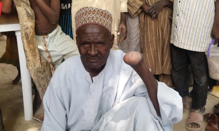 Ali Falfami, 73, had his hand removed after being shot by Boko Haram fighters