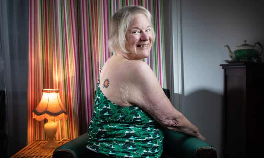 Sarah Browne, a person over 65 who got their first tattoo. She was badly burned as a child, and has a tattoo on the middle of her back over the worst of her skin grafts. for G2
