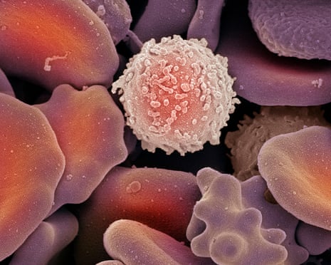 Blood cells, SEM<br>Blood cells. Coloured scanning electron micrograph (SEM) of red blood cells and one white blood cell (upper centre). Red blood cells (erythrocytes) are responsible for carrying oxygen around the body, and for carrying waste carbon dioxide to the lungs for exhalation. White blood cells (leucocytes) are part of the immune system, which protects the body from invading micro-organisms. Magnification: x5000 when printed 10cm wide.