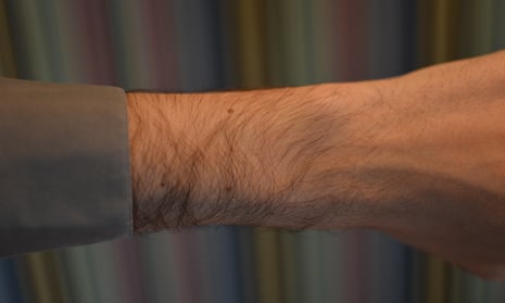 My wrist without an Apple Watch.