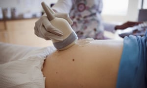 dating ultrasound miscarriage