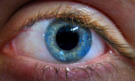 Generic photo of an eye