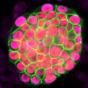 a microscopic view of a colony of induced pluripotent stem cells
