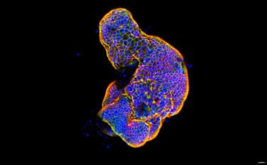 Lab-grown human intestinal tissue showing glowing, brick-like epithelial cell connections that form the intestine’s protective barrier