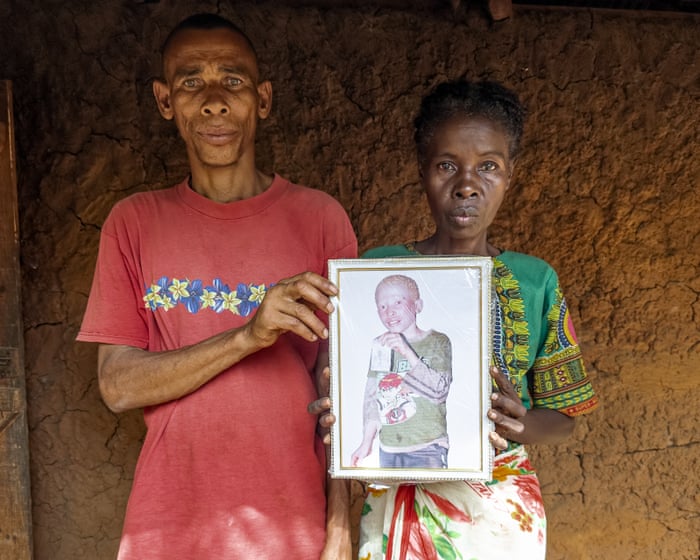 Murdered for their eyes: people with albinism living in terror in Madagascar