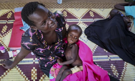 Kombangako Mawa, 19 months old, who has been in hospital suffering from oedema due to malnutrition, sits on his mother’s lap at a feeding centre