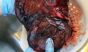 Natuurlijke menselijke placenta.