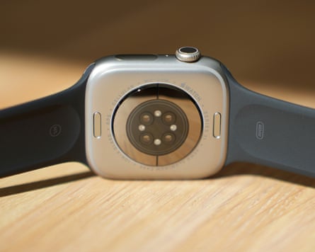 The back sensor cluster of the Apple Watch Series 11.