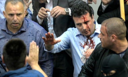 Zoran Zaev, then opposition leader, bloodied during violence in Macedonia’s parliament in April.