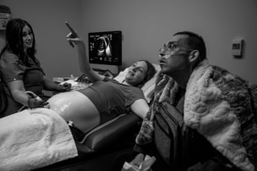 Black and white image of Shay and Tanner viewing sonogram images of their daughter during a prenatal checkup