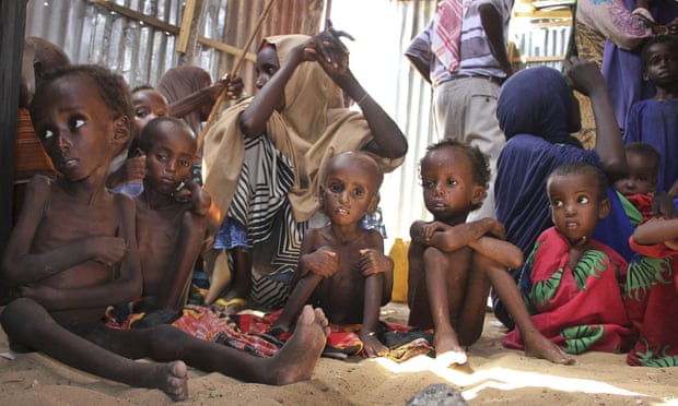 Malnourished Somali children