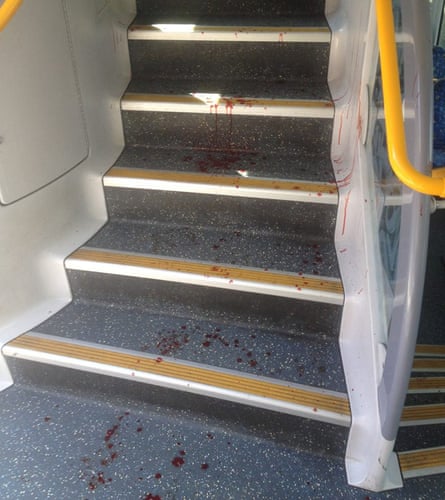Richmond train crash bloodstains