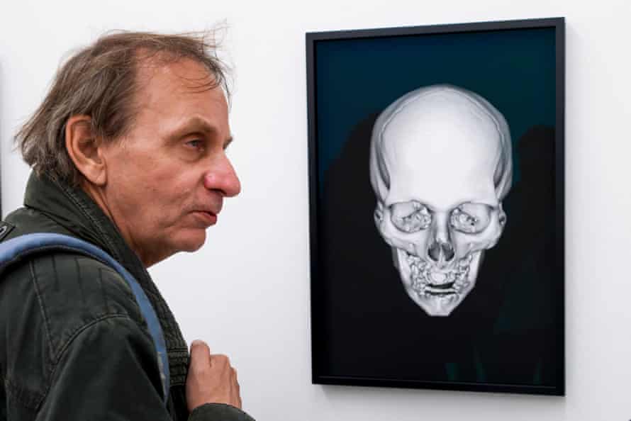 French author Michel Houellebecq ponders his X-rayed skull at Manifesta 11 in Zurich.